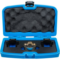 Coffret de calage | pour Mercedes-Benz OM651